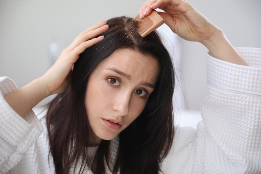 Can Bedding Cause Acne and Dandruff? Explore the Connection!